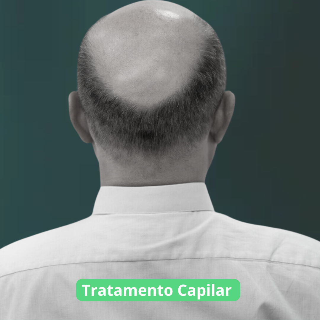 Inserir-um-titulo-22.png